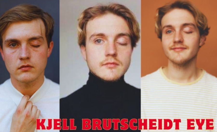 kjell brutscheidt eye