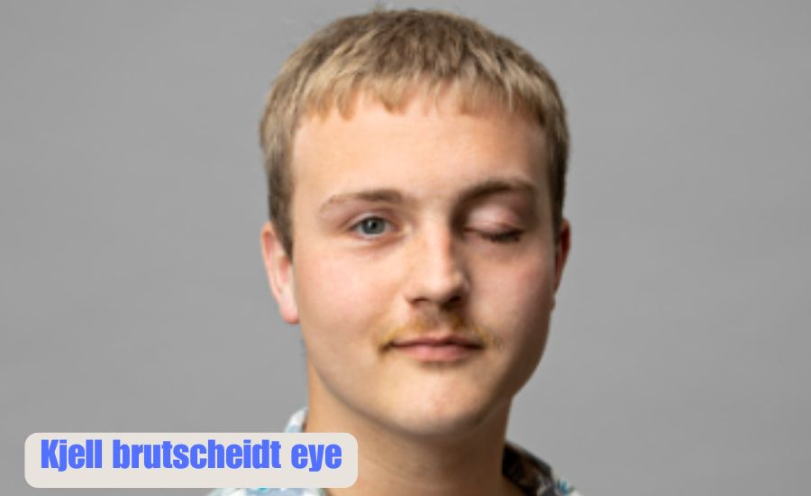 kjell brutscheidt eye